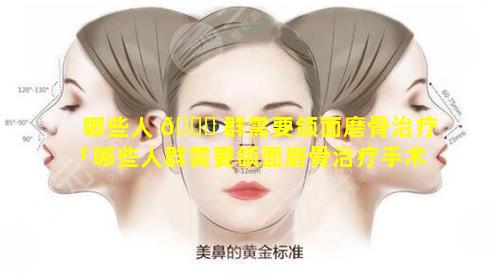 哪些人 🐞 群需要颌面磨骨治疗「哪些人群需要颌面磨骨治疗手术」